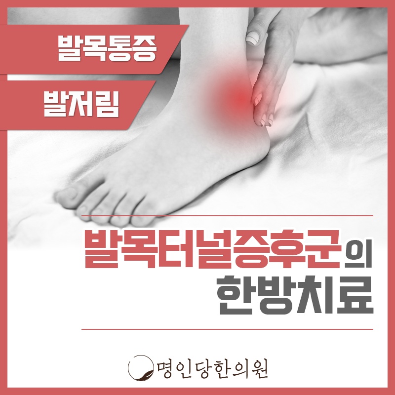발목터널증후군 복사뼈 살짝 눌러도 통증, 창원시청 상남동 한의원 봉침치료