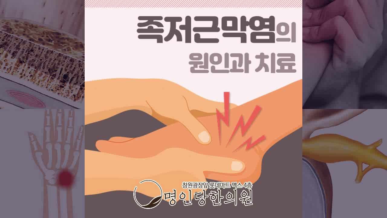 창원시청 상남동 족저근막염 발바닥 통증 오는 이유, 침치료 명인당한의원