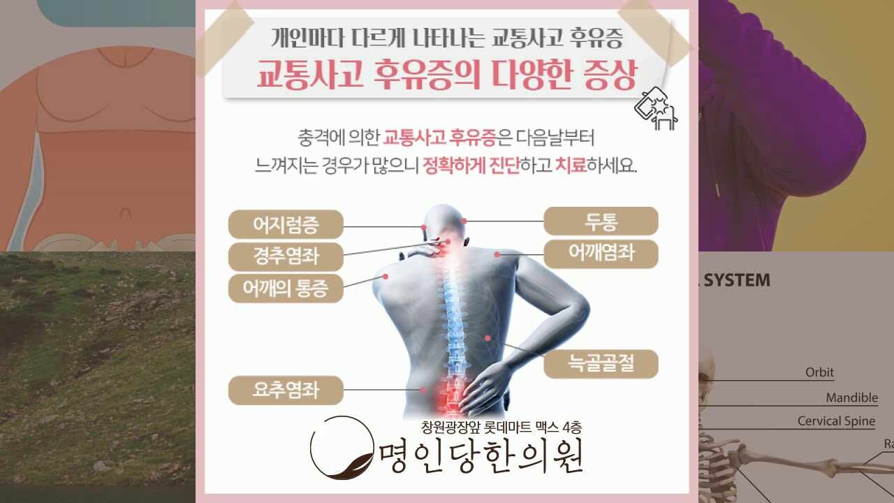 자동차사고후유증으로 생긴 어지럼증 두통 개선해요, 창원시청 상남동 추나요법 한의원
