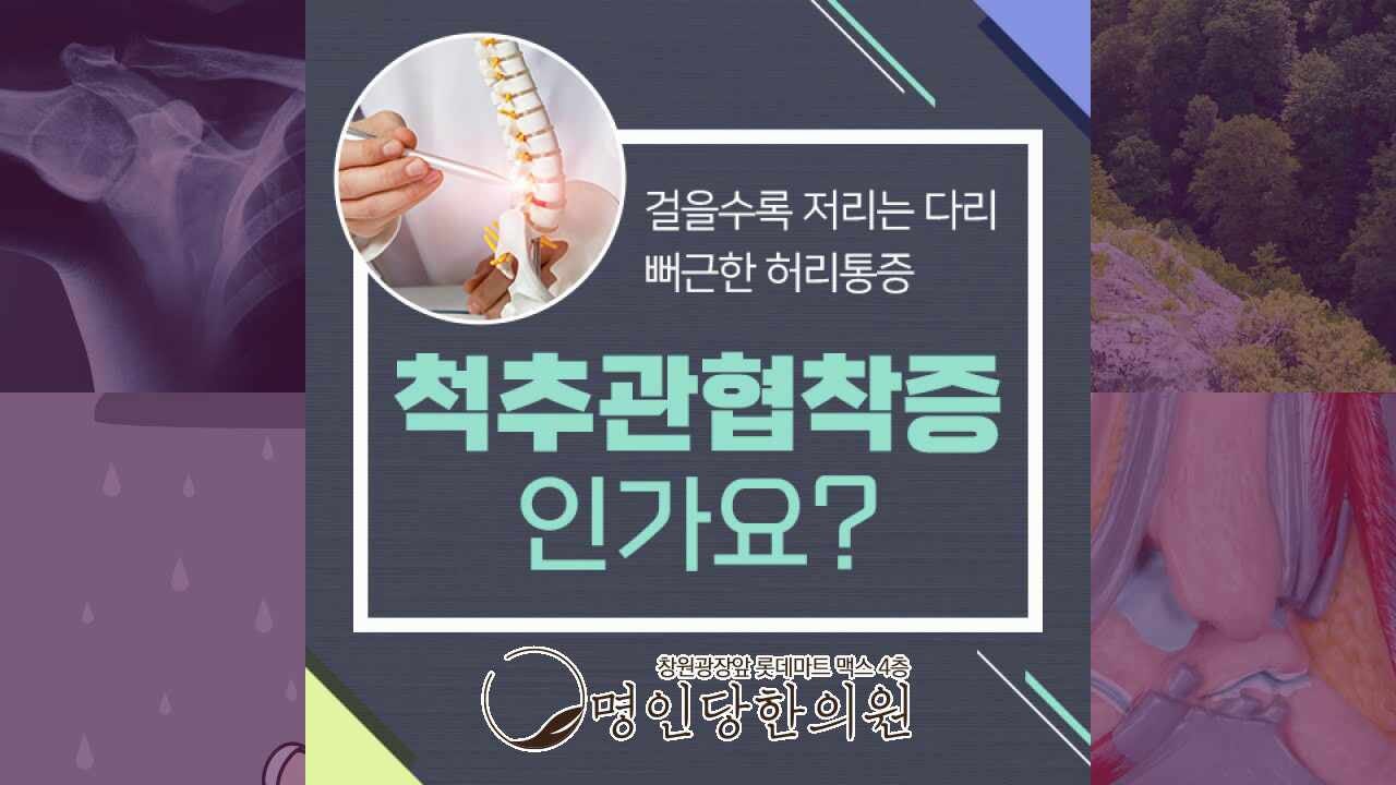 척추관협착증 터질듯한 다리 어떻게, 창원 중앙동 한의원 추나요법