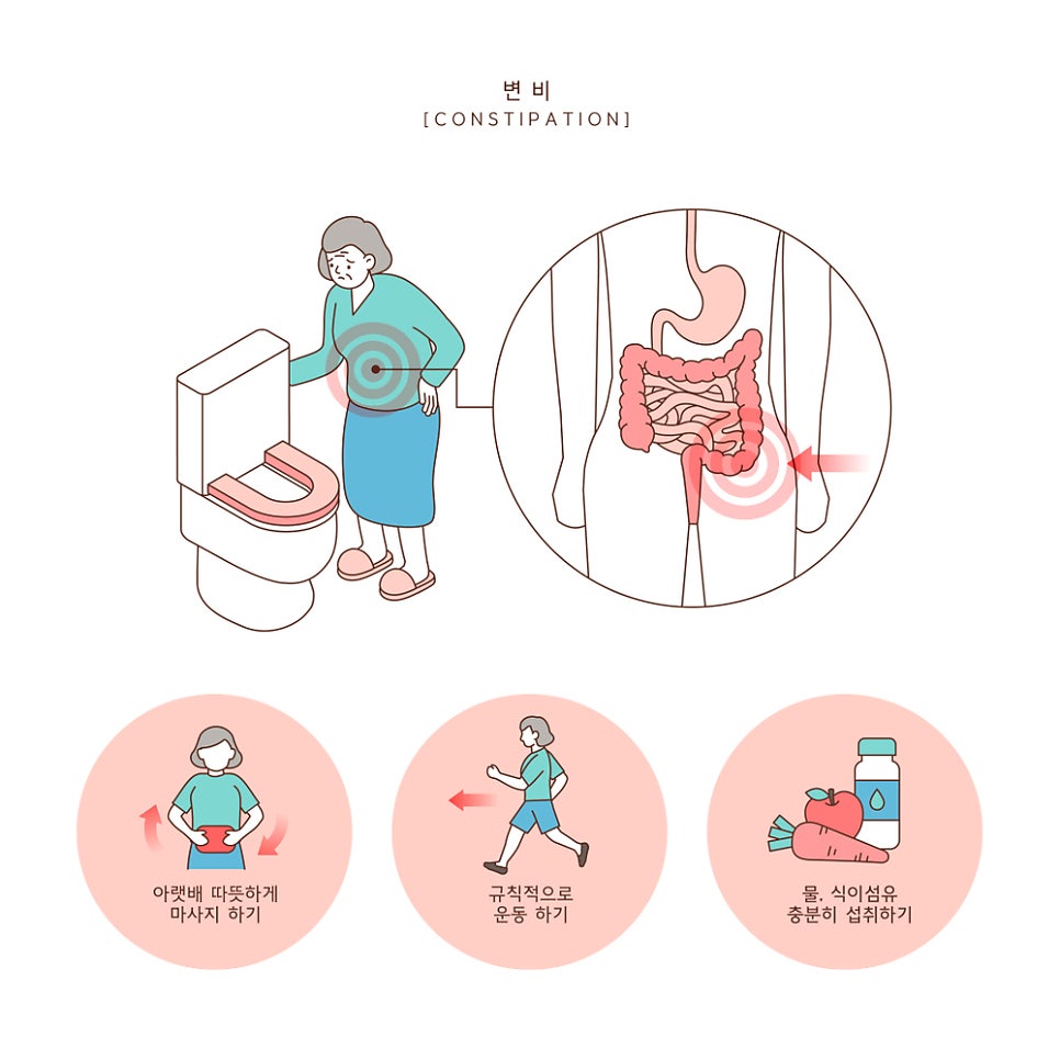 만성 중증 변비에 침 치료가 변비약보다 못하지 않다는데~?