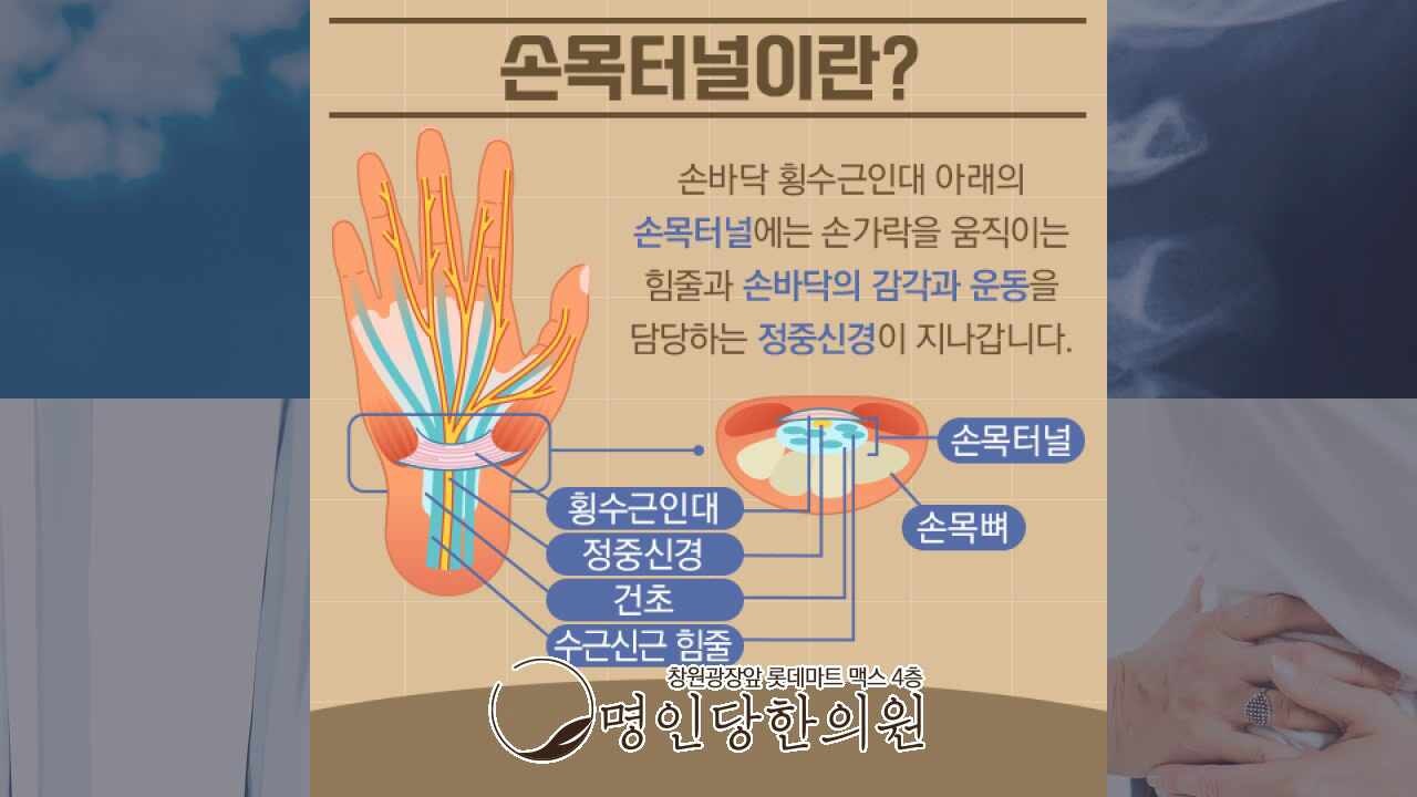 손목 아픈 나는 창원 상남동 손목터널증후군일까 알아보자, 침치료 한의원 여성한의사 진료