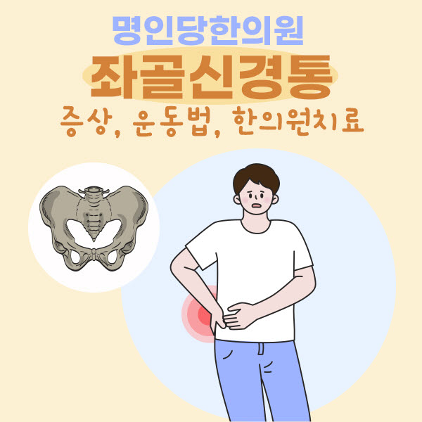 좌골신경통 증상, 운동법, 한의원치료까지