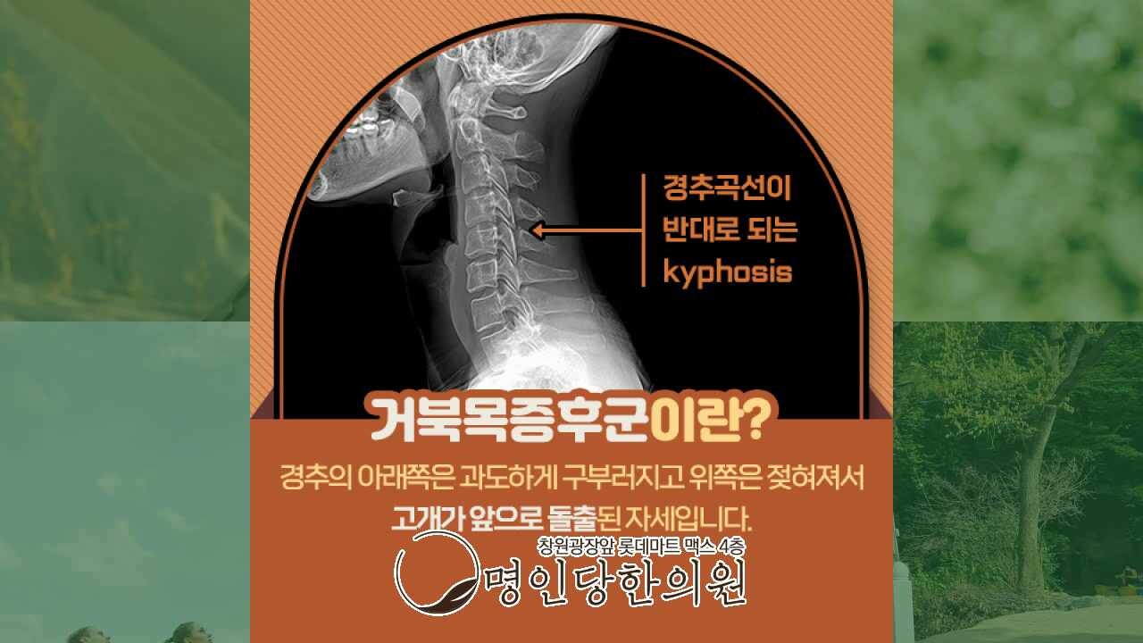 거북목증후군 목이 앞으로, 창원 중앙동 추나요법 명인당한의원
