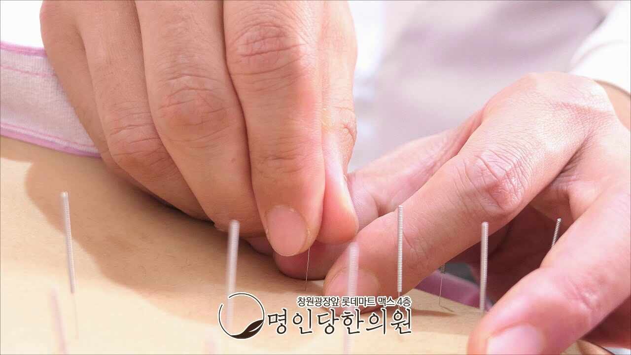 테니스엘보 물건 이동할 때 팔꿈치가 찌릿해, 창원시청 상남동 한의원 추나요법 여성한의사 진료