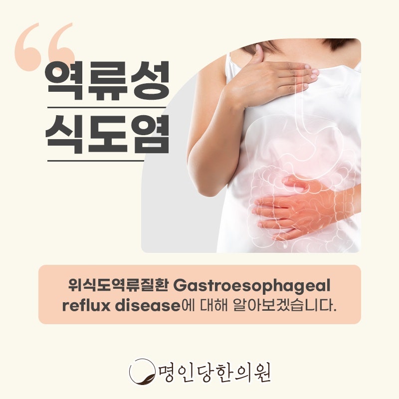 창원 중앙동 역류성식도염 위와 식도사이에 문제, 한의원
