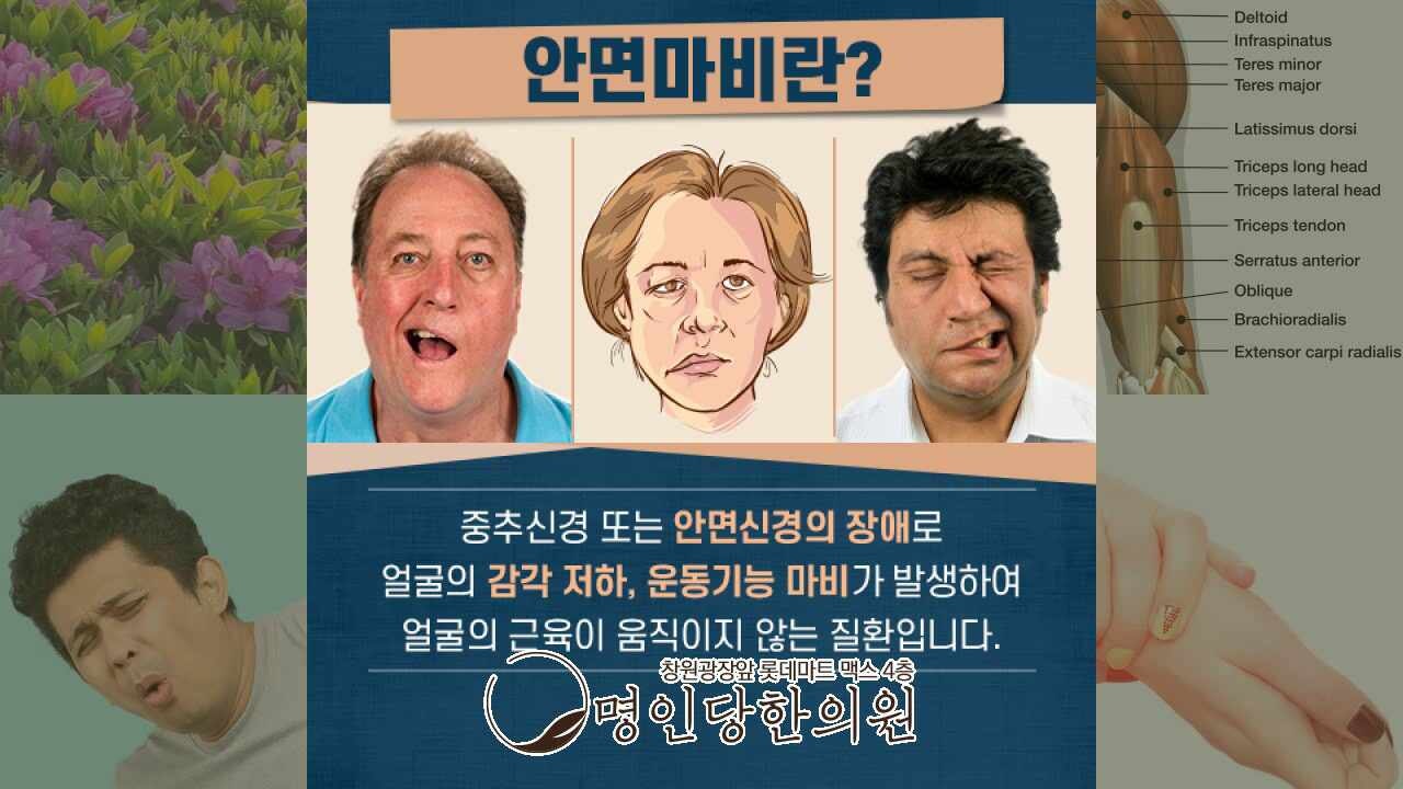 안면마비 스트레스 받지 말기, 창원시청 상남동 추나 명인당한의원