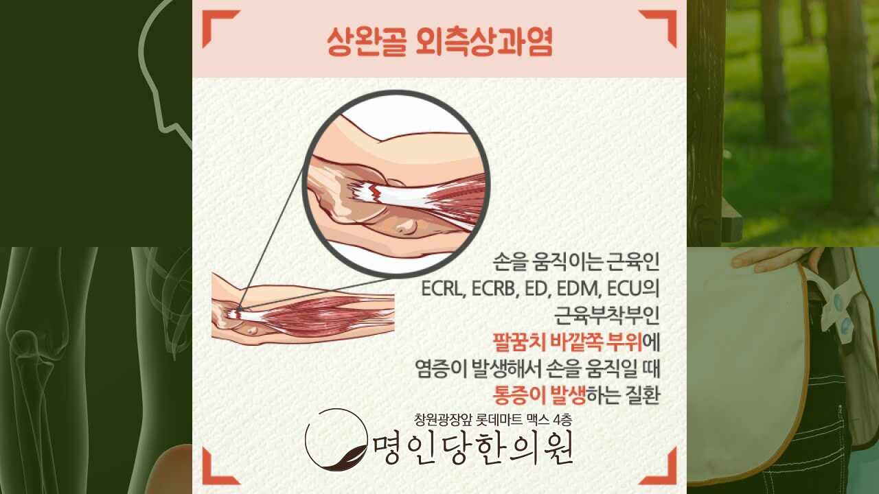 시큰한 팔꿈치 테니스엘보 온 것 같아, 창원시청 상남동 추나치료 한의원