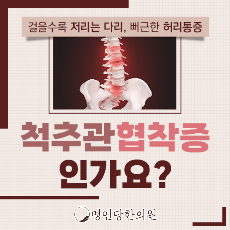 척추관협착증 노년층은 더욱 주의하세요, 창원 상남동 한의원 보약, 한약치료