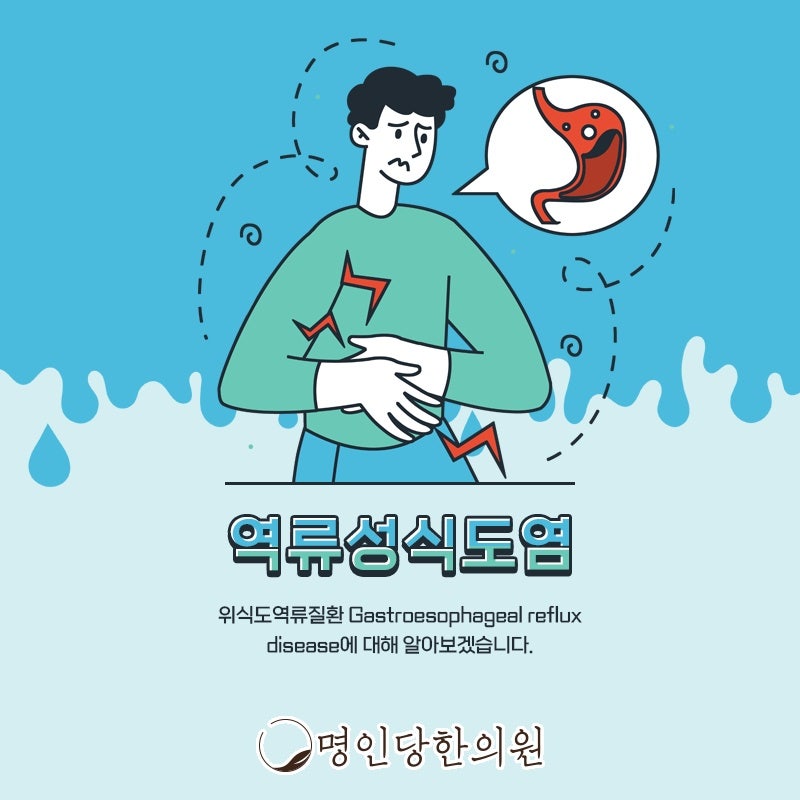 창원 중앙동 역류성식도염 느슨해진 하부식도괄약근이 역류 막지 못해, 명인당한의원