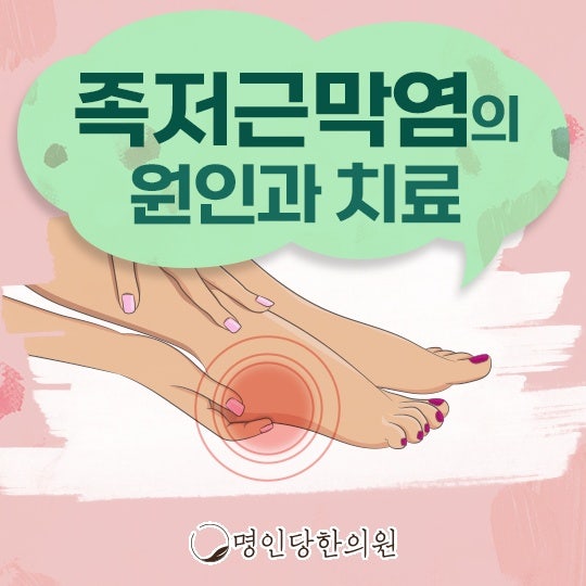 족저근막염 발바닥에 타는듯한 통증, 창원 상남동 봉침치료 명인당한의원