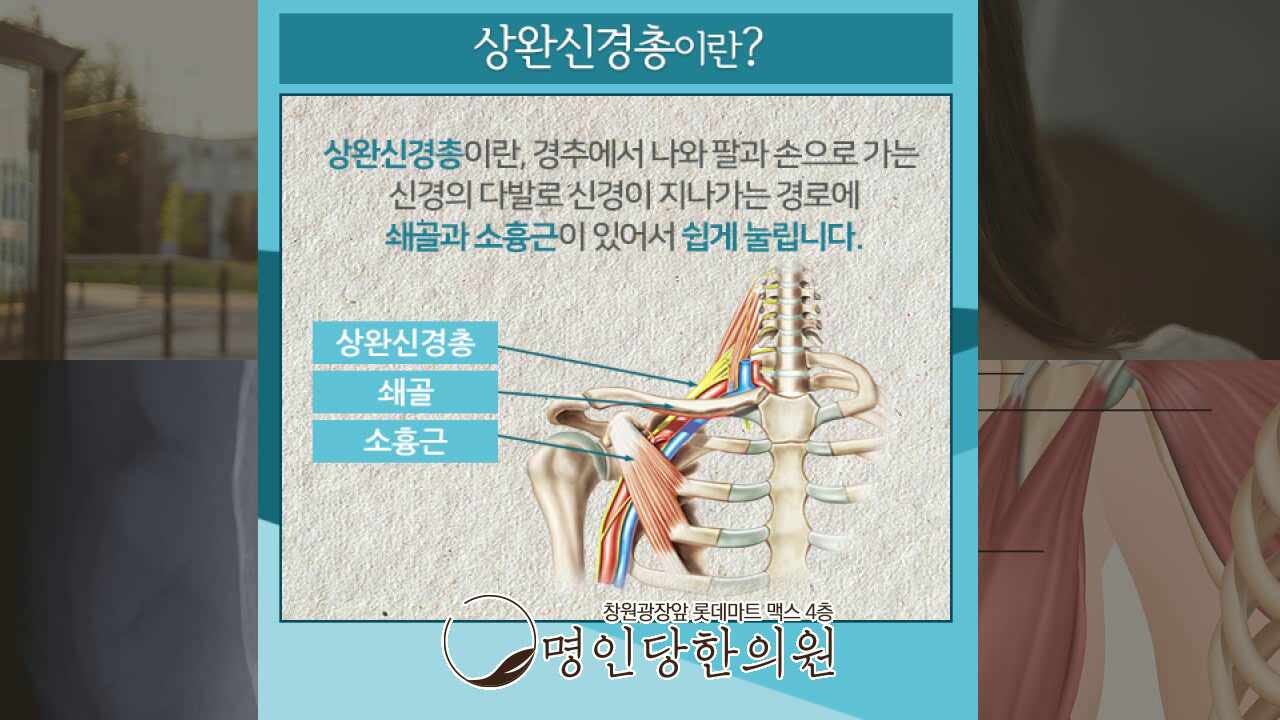 추나치료 한의원, 상남동흉곽출구증후군 팔과 가슴에 통증이 있다면 일요일진료