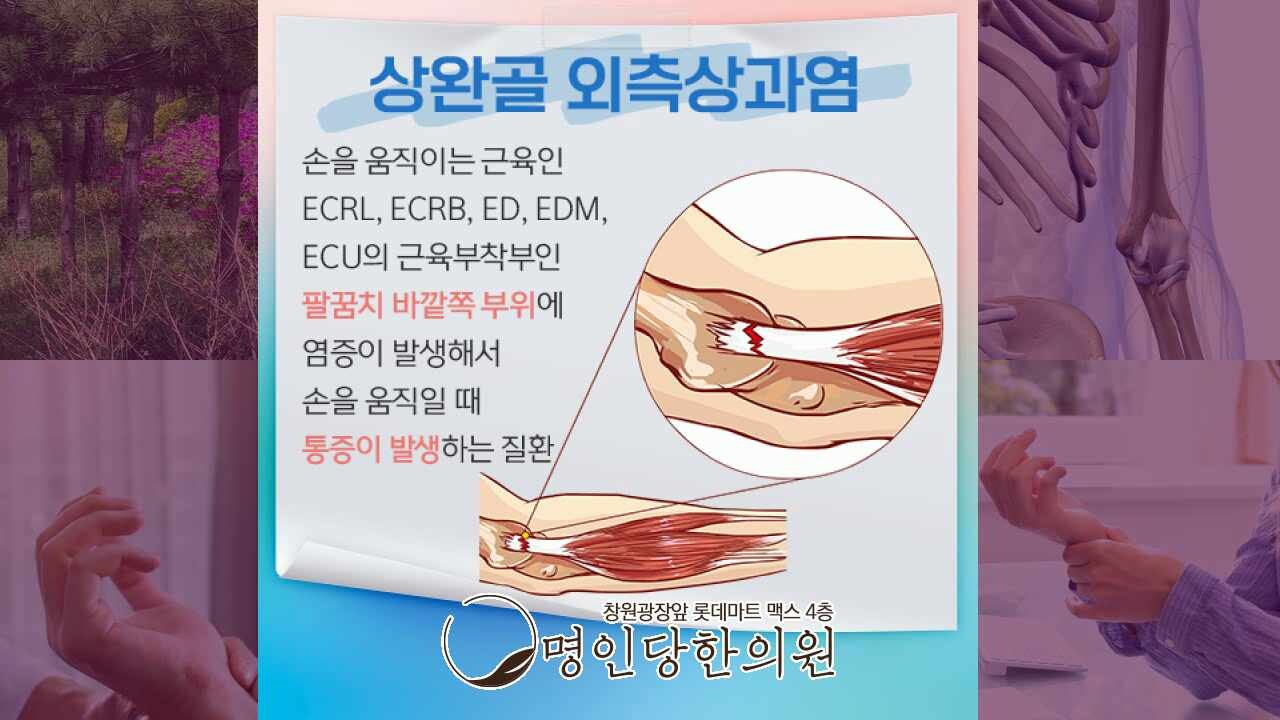 테니스엘보 왜 팔꿈치 바깥쪽에 염증이 생길까요, 상남동 추나요법 한의원