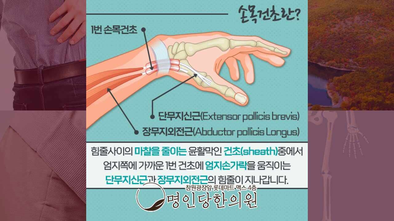 창원 중앙동 손목건초염 엄지에 저림이 잦다면, 봉침치료 명인당한의원
