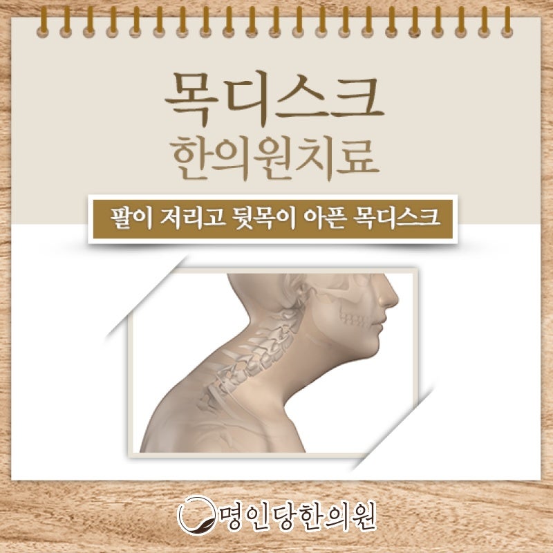 목디스크 비수술적으로 개선할 수 있어, 창원 상남동 약침치료 명인당한의원