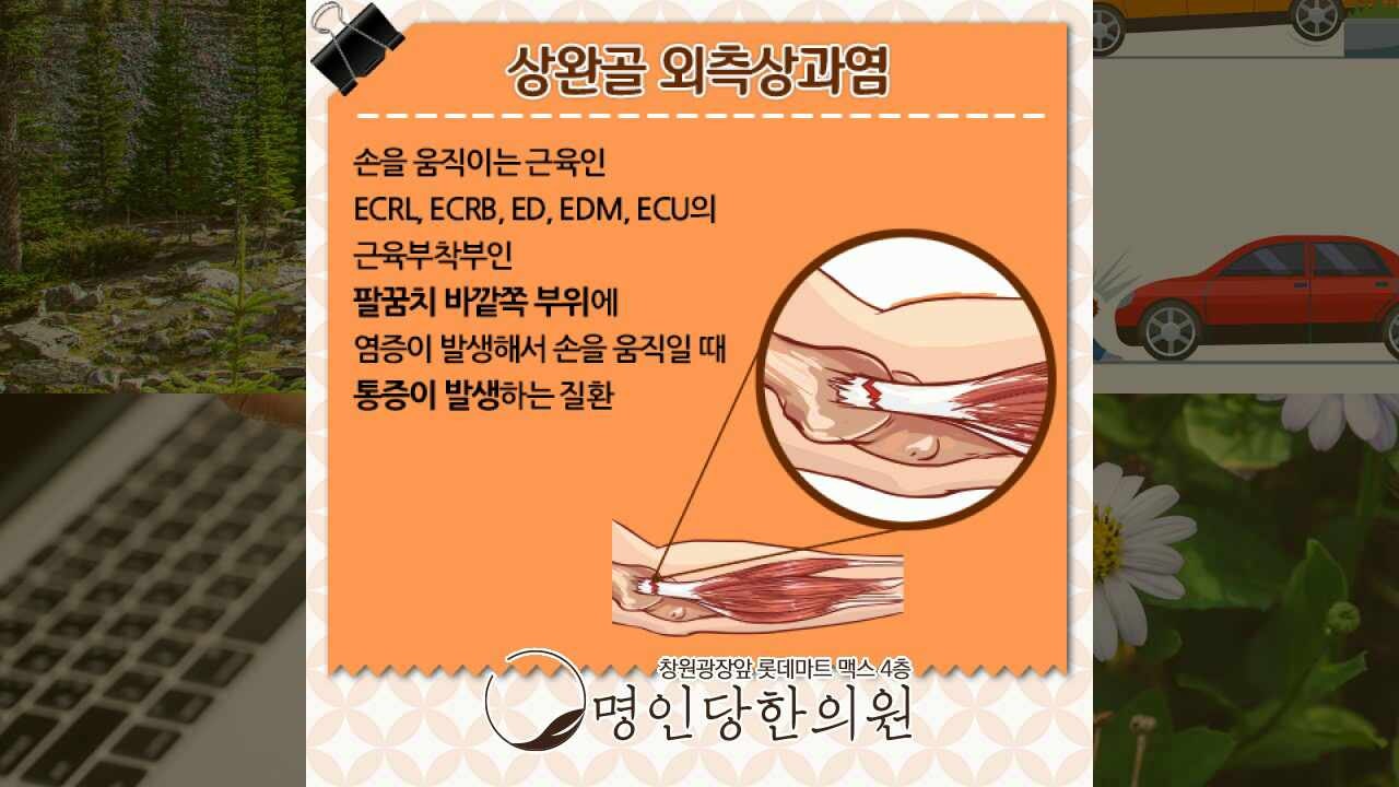 창원 상남동 테니스엘보 팔꿈치통증 회복을 위해, 추나 명인당한의원
