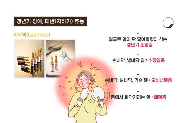 갱년기 장애에 좋은 태반약침치료&체중증가 고민해결!