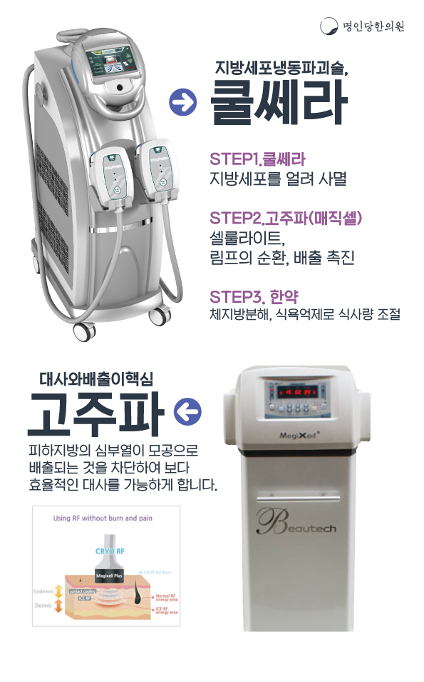 창원다이어트한의원/살찌는 원인에 맞춘 한방치료로 체중감량 성공[창원명인당한의원]