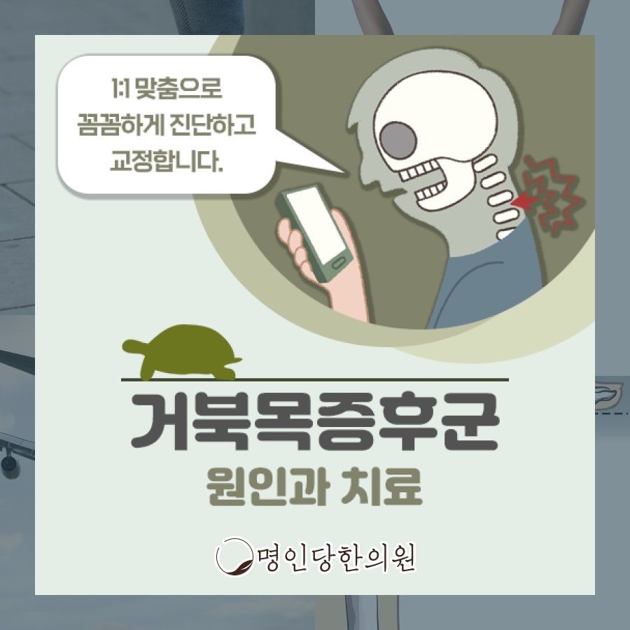 거북목증후군 때문에 머리도 욱신욱신, 창원시청 상남동한의원 추나치료