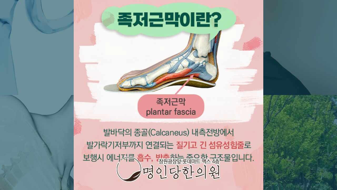창원 상남동 족저근막염 찢어질듯한 발바닥 통증, 약침치료 한의원 여한의사 진료