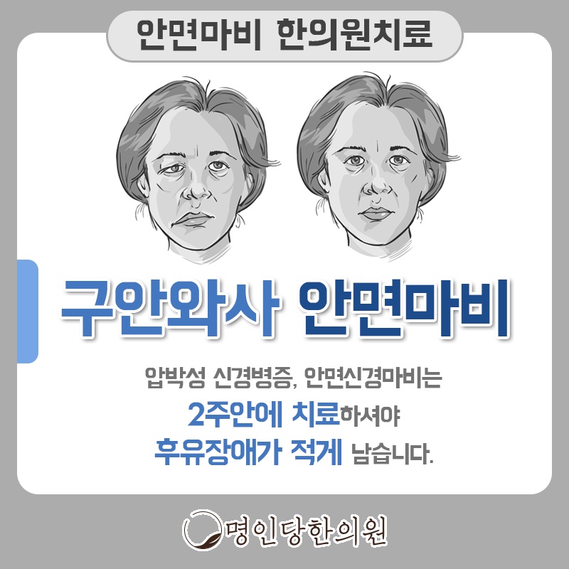 안면신경마비 시기 놓치면 후유증 걱정, 창원시청 상남동 추나요법 명인당한의원