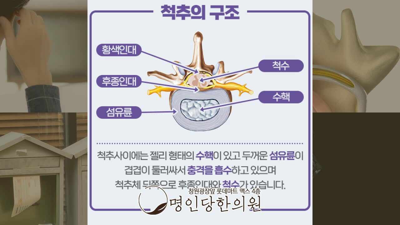 창원 상남동 허리디스크(요추 추간판 탈출증) 다리에 저림 있다면, 추나요법 한의원 일요일진료