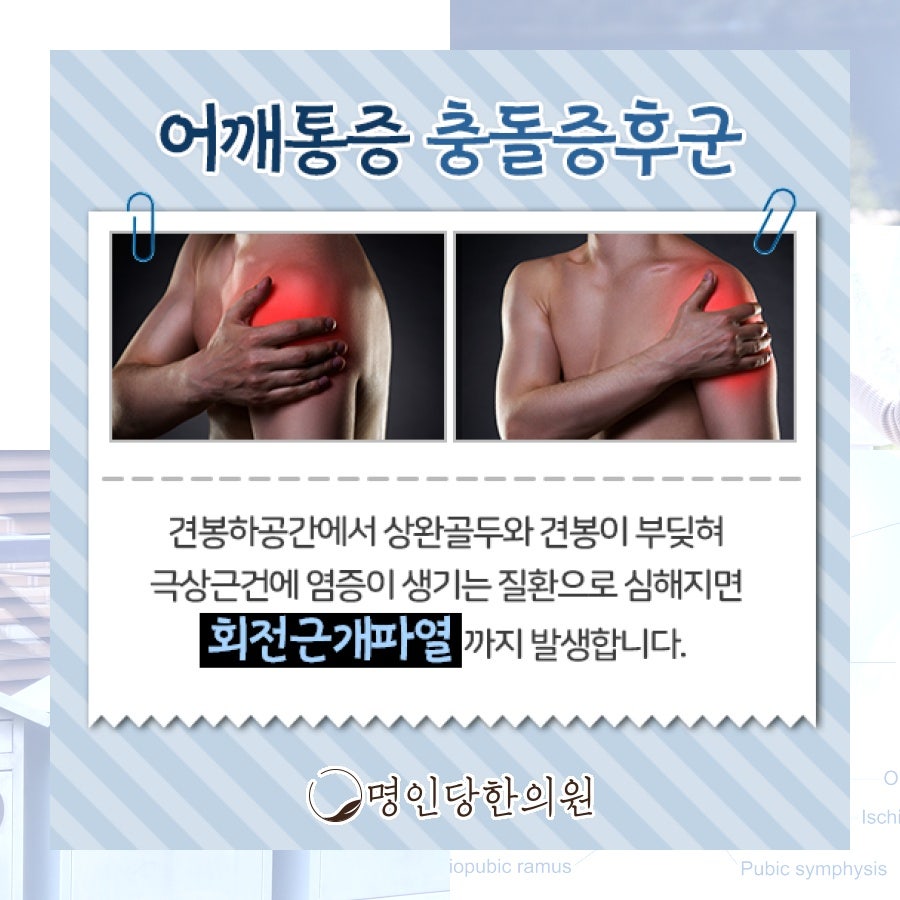 어깨통증 충돌증후군 무엇이 원인일까, 창원 상남동 추나치료 한의원 일요일치료