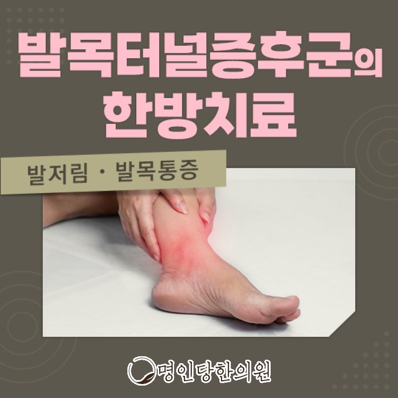 창원 상남동 발목터널증후군 안쪽 복사뼈에 통증, 봉침 한의원